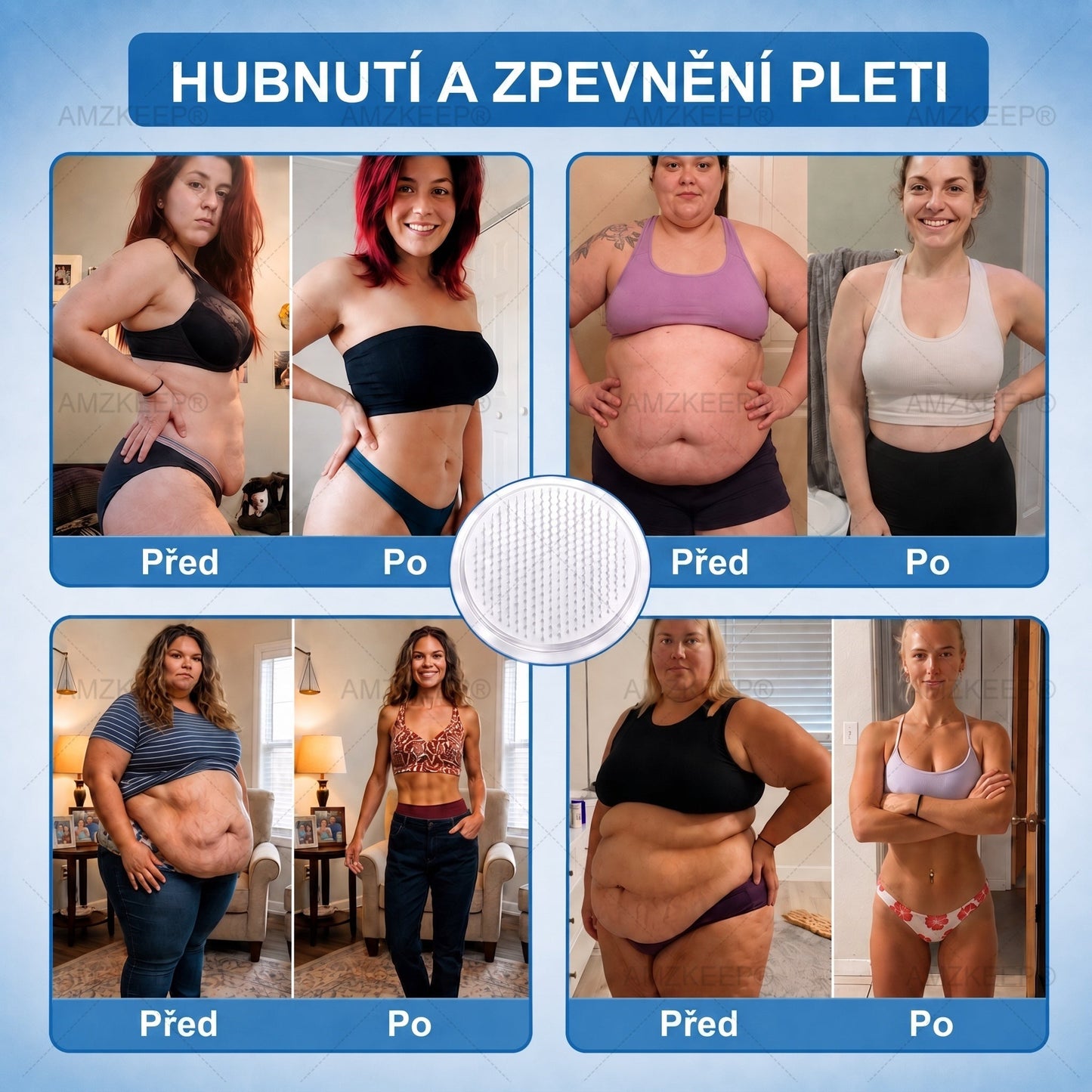 𝐀𝗠𝒁𝑲𝗘𝑬𝙋® 𝐀𝗠𝗣𝑲𝐌𝗼𝗿𝗶𝗻𝗴𝗮𝐁𝗲𝗿𝗯𝗲𝗿𝗶𝗻𝗲 𝟏𝟎-𝗶𝗻-𝟏 𝐌𝗲𝘁𝗮𝗯𝗼𝗹𝗶𝗰 𝐒𝘂𝗽𝗽𝗼𝗿𝘁 𝐍𝗮𝗻𝗼 𝐌𝗶𝗰𝗿𝗼𝗻𝗲𝗲𝗱𝗹𝗲 𝐏𝗮𝘁𝗰𝗵 🇨🇿(𝗝𝗲𝗱𝗻𝗼𝘂 𝗱𝗲𝗻𝗻ě, 𝗩𝗶𝗱𝗶𝘁𝗲𝗹𝗻é 𝘃ý𝘀𝗹𝗲𝗱𝗸𝘆 𝘇𝗮 𝟳 𝗱𝗻í)✅ 𝗣𝗿𝗼 𝗻𝗮𝗱𝘃á𝗵𝘂, 𝘂𝘃𝗼𝗹𝗻ě𝗻𝗼𝘂 𝗸ůž𝗶, 𝗱𝗶𝗮𝗯𝗲𝘁𝗲𝘀, 𝘀𝗽á𝗻𝗸𝗼𝘃𝗼𝘂 𝗮𝗽𝗻𝗼𝗲, 𝗽𝗿𝗼𝗯𝗹é𝗺𝘆 𝘀 𝗸𝗹𝗼𝘂𝗯𝘆 𝗮 𝗱𝗮𝗹ší