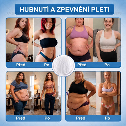 𝐀𝗠𝒁𝑲𝗘𝑬𝙋® 𝐀𝗠𝗣𝑲𝐌𝗼𝗿𝗶𝗻𝗴𝗮𝐁𝗲𝗿𝗯𝗲𝗿𝗶𝗻𝗲 𝟏𝟎-𝗶𝗻-𝟏 𝐌𝗲𝘁𝗮𝗯𝗼𝗹𝗶𝗰 𝐒𝘂𝗽𝗽𝗼𝗿𝘁 𝐍𝗮𝗻𝗼 𝐌𝗶𝗰𝗿𝗼𝗻𝗲𝗲𝗱𝗹𝗲 𝐏𝗮𝘁𝗰𝗵 🇨🇿(𝗝𝗲𝗱𝗻𝗼𝘂 𝗱𝗲𝗻𝗻ě, 𝗩𝗶𝗱𝗶𝘁𝗲𝗹𝗻é 𝘃ý𝘀𝗹𝗲𝗱𝗸𝘆 𝘇𝗮 𝟳 𝗱𝗻í)✅ 𝗣𝗿𝗼 𝗻𝗮𝗱𝘃á𝗵𝘂, 𝘂𝘃𝗼𝗹𝗻ě𝗻𝗼𝘂 𝗸ůž𝗶, 𝗱𝗶𝗮𝗯𝗲𝘁𝗲𝘀, 𝘀𝗽á𝗻𝗸𝗼𝘃𝗼𝘂 𝗮𝗽𝗻𝗼𝗲, 𝗽𝗿𝗼𝗯𝗹é𝗺𝘆 𝘀 𝗸𝗹𝗼𝘂𝗯𝘆 𝗮 𝗱𝗮𝗹ší