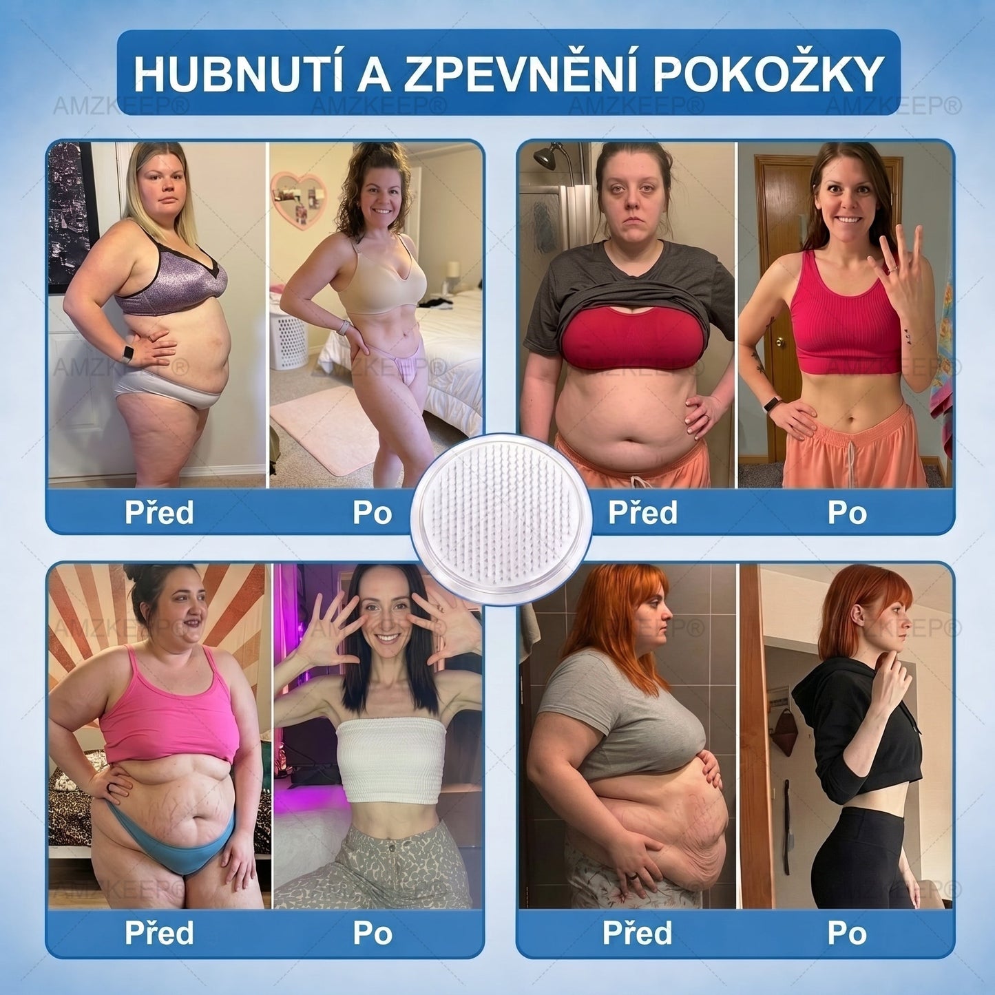 𝐀𝗠𝒁𝑲𝗘𝑬𝙋® 𝐀𝗠𝗣𝑲𝐌𝗼𝗿𝗶𝗻𝗴𝗮𝐁𝗲𝗿𝗯𝗲𝗿𝗶𝗻𝗲 𝟏𝟎-𝗶𝗻-𝟏 𝐌𝗲𝘁𝗮𝗯𝗼𝗹𝗶𝗰 𝐒𝘂𝗽𝗽𝗼𝗿𝘁 𝐍𝗮𝗻𝗼 𝐌𝗶𝗰𝗿𝗼𝗻𝗲𝗲𝗱𝗹𝗲 𝐏𝗮𝘁𝗰𝗵 🇨🇿(𝗝𝗲𝗱𝗻𝗼𝘂 𝗱𝗲𝗻𝗻ě, 𝗩𝗶𝗱𝗶𝘁𝗲𝗹𝗻é 𝘃ý𝘀𝗹𝗲𝗱𝗸𝘆 𝘇𝗮 𝟳 𝗱𝗻í)✅ 𝗣𝗿𝗼 𝗻𝗮𝗱𝘃á𝗵𝘂, 𝘂𝘃𝗼𝗹𝗻ě𝗻𝗼𝘂 𝗸ůž𝗶, 𝗱𝗶𝗮𝗯𝗲𝘁𝗲𝘀, 𝘀𝗽á𝗻𝗸𝗼𝘃𝗼𝘂 𝗮𝗽𝗻𝗼𝗲, 𝗽𝗿𝗼𝗯𝗹é𝗺𝘆 𝘀 𝗸𝗹𝗼𝘂𝗯𝘆 𝗮 𝗱𝗮𝗹ší