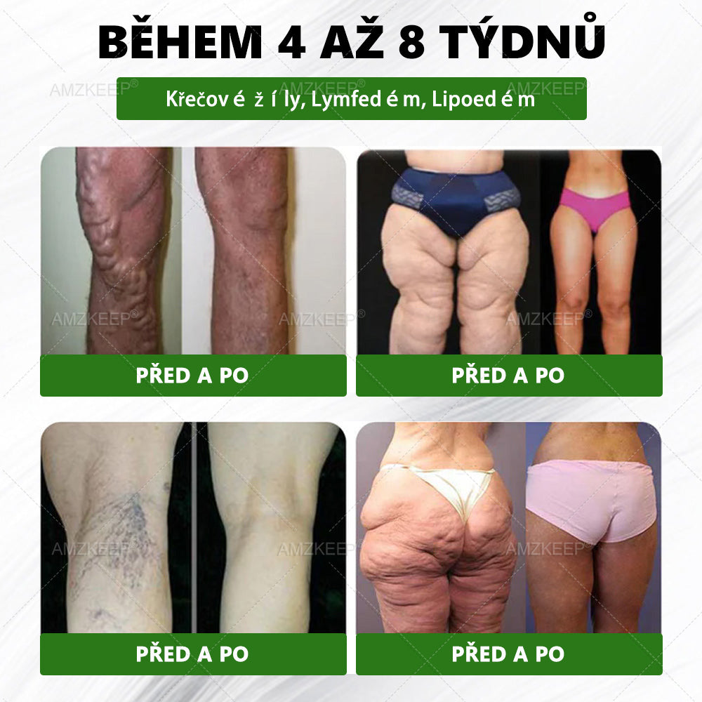 🎁 Zbývají už jen 5 krabic! Nabízíme vám dodatečnou slevu 50%! Zkráťte se a buďte zdraví. Koupte si to hned, nebude vám další šance až do příštího roku.