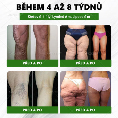 🎁 Zbývají už jen 5 krabic! Nabízíme vám dodatečnou slevu 50%! Zkráťte se a buďte zdraví. Koupte si to hned, nebude vám další šance až do příštího roku.